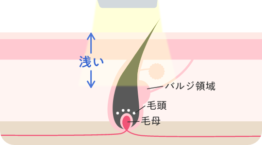 エステ脱毛の仕組み