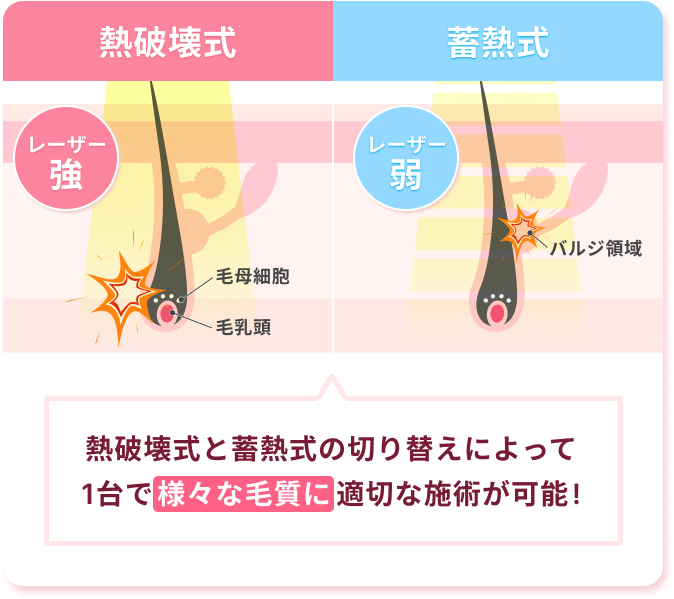 熱破壊式と蓄熱式の切り替えによって1台で様々な毛質に適切な施術が可能