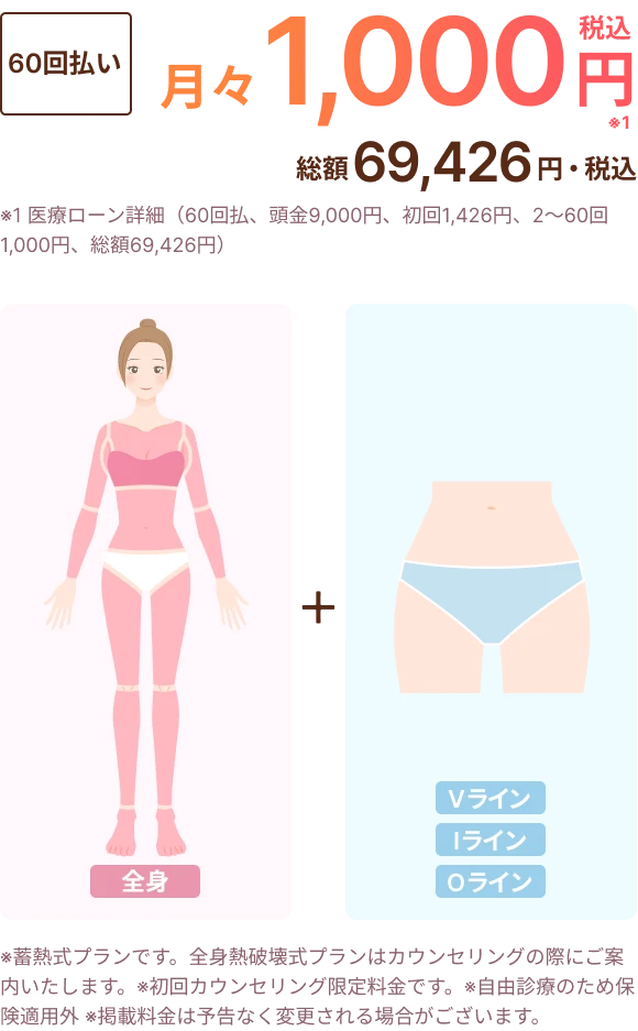 全身＋VIOプラン料金