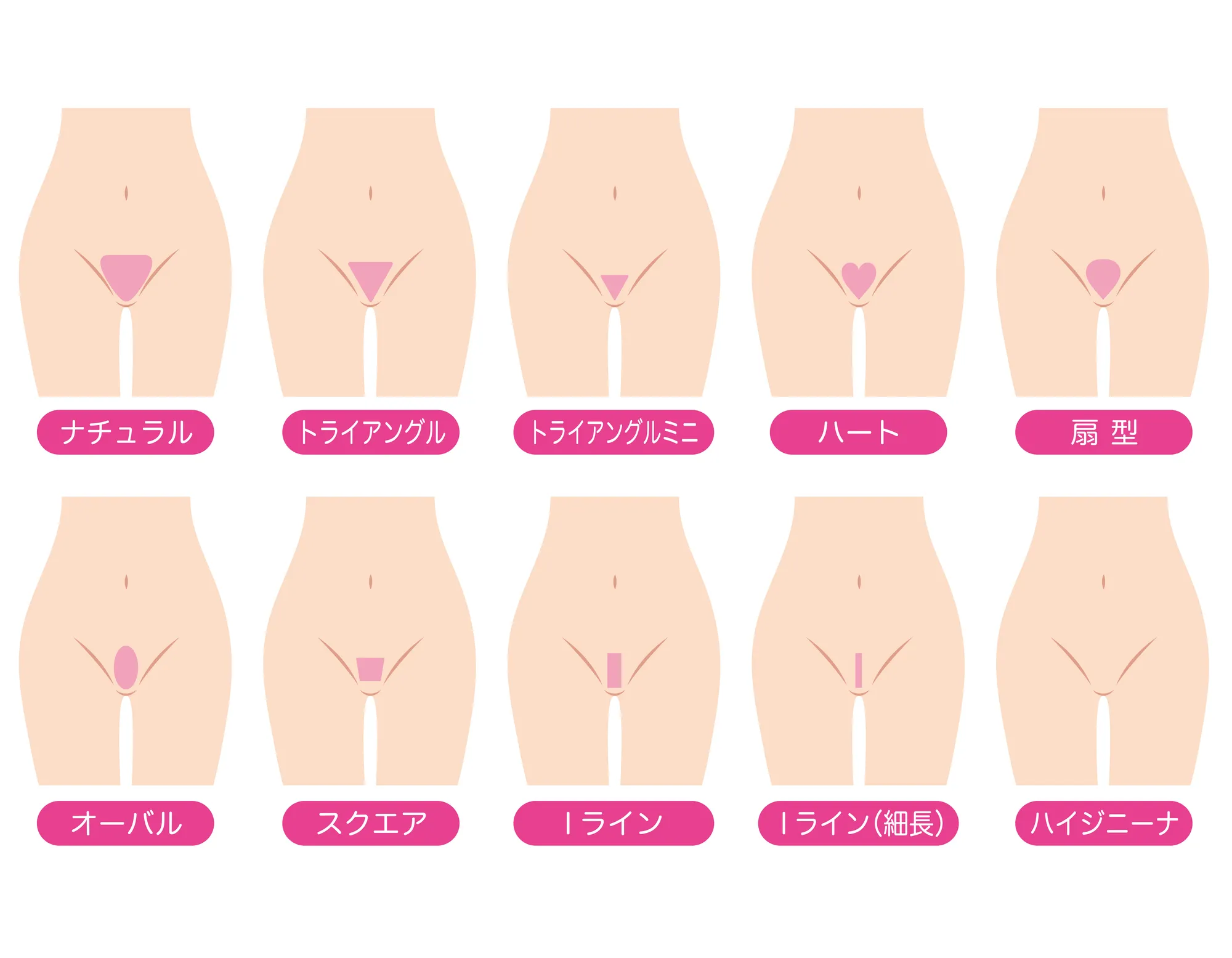 人気のVIOデザイン