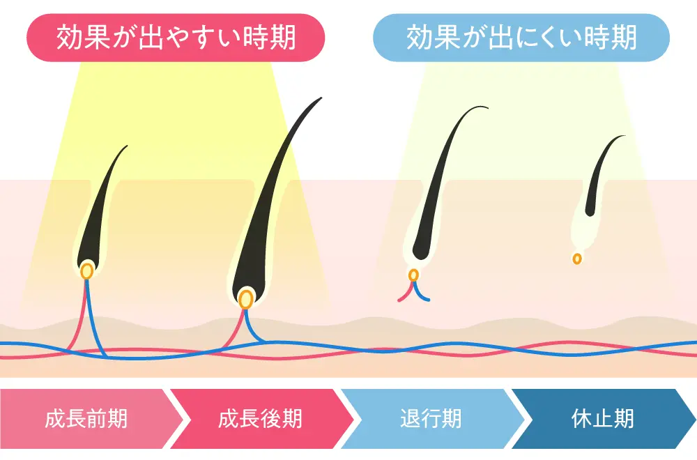 毛周期を説明するイラスト