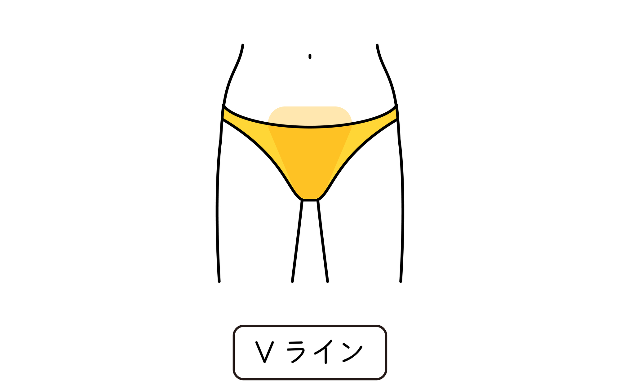 Vライン（ビキニライン）脱毛とは